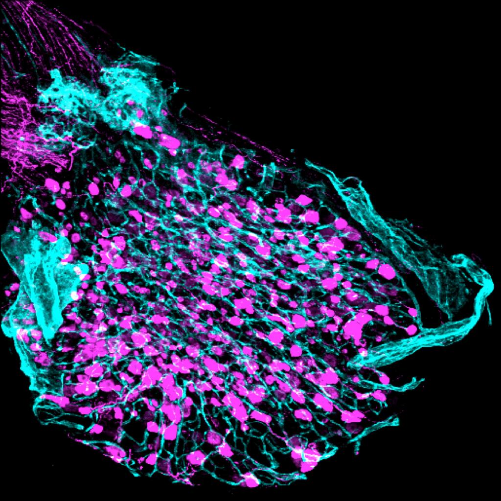 Confocal image of a dorsal root ganglion (DRG) stained with CD31 blood vessels (blue) and TrkA positive expression (magenta). 