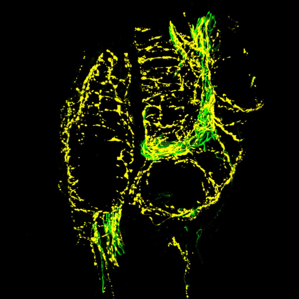Confocal image illustrating the interaction of NF200 sensory fibers (green) and TH sympathetic nerve fibers (yellow) in a nonhealed, fractured femur. This interaction is never observed in a normal femur.