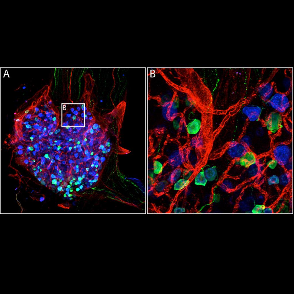 Confocal image of CD31 blood vessels (red), CGRP positive and TrkA positive expression (blue, green) in a dorsal root ganglion. Note the higher power image (B) illustrating the cellular morphology. 